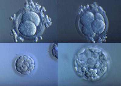 Fécondation in vitro : trente ans de bébés éprouvés