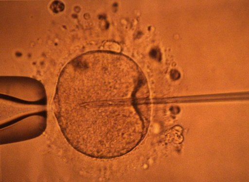 Fécondation in Vitro